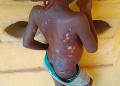 Police Arrest Mother Over Alleged Brutal Abuse Of 7-Year-Old Girl In Anambra
